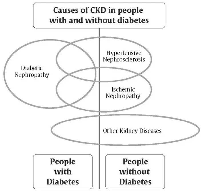 Ch29-Fig1-Causes-of-CKD-in-people-with-and-without-diabetes Ch29-Fig1-Causes-of-CKD-in-people-with-and-without-diabetes